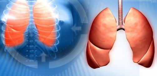 саркоидоз легких