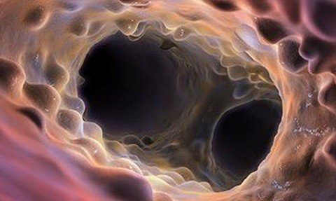 саркоидоз легких