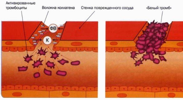 профилактика тромбоза