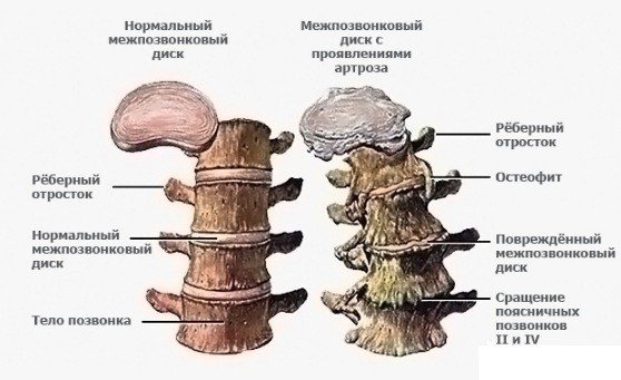 здоровье позвоночника