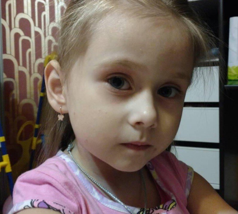 атопический дерматит