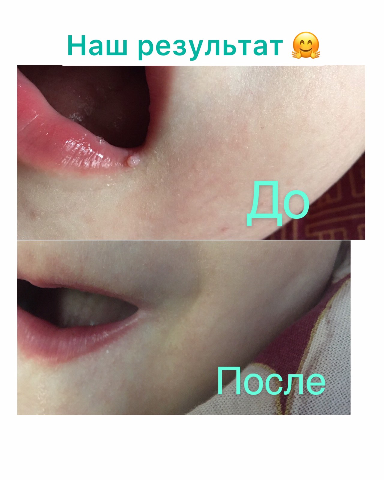 результат НСП