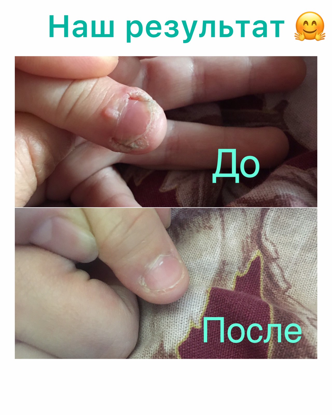 результат НСП